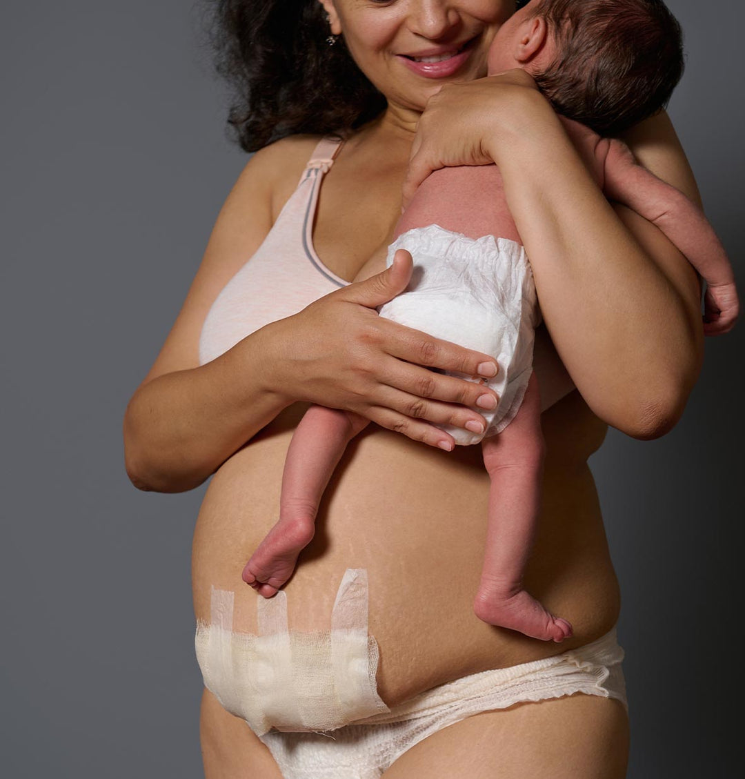 Si të rikuperohemi pas lindjes Cezariane?